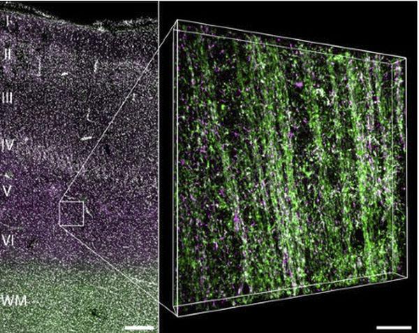 Epilepsie auf molekularer Ebene

Der Ausschnitt aus der Großhirnrinde zeigt die Myelinfasern, die die Nervenzellen elektrisch abschirmen (grün/lila). 

Cerebral Cortex/Oxford University Press