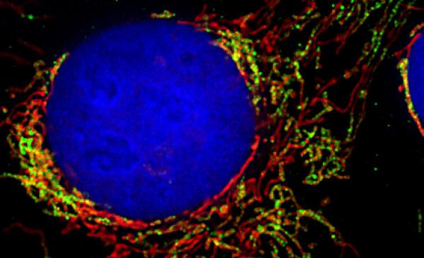 Zellkontrolle der Mitochondrien entschlüsselt.
Das Netzwerk der Mitochondrien zieht sich schnurartig durch die gesamte menschliche Zelle (in grün und rot mit Fluoreszenzproteinen markiert). Der Zellkern ist blau angefärbt.
Foto: Albert-Ludwigs-Universität Freiburg - Pablo Sánchez-Martín Zellkontrolle der Mitochondrien entschlüsselt.
Das Netzwerk der Mitochondrien zieht sich schnurartig durch die gesamte menschliche Zelle (in grün und rot mit Fluoreszenzproteinen markiert). Der Zellkern ist blau angefärbt.
Foto: Albert-Ludwigs-Universität Freiburg - Pablo Sánchez-Martín